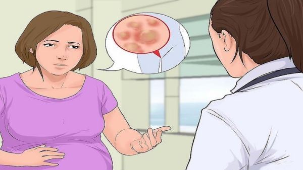 درمان قطعی زگیل تناسلی خانمها و آقایان