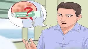 درمان قطعی زگیل تناسلی خانمها و آقایان