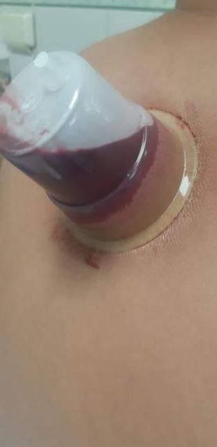 مرکزحجامت در رودهن