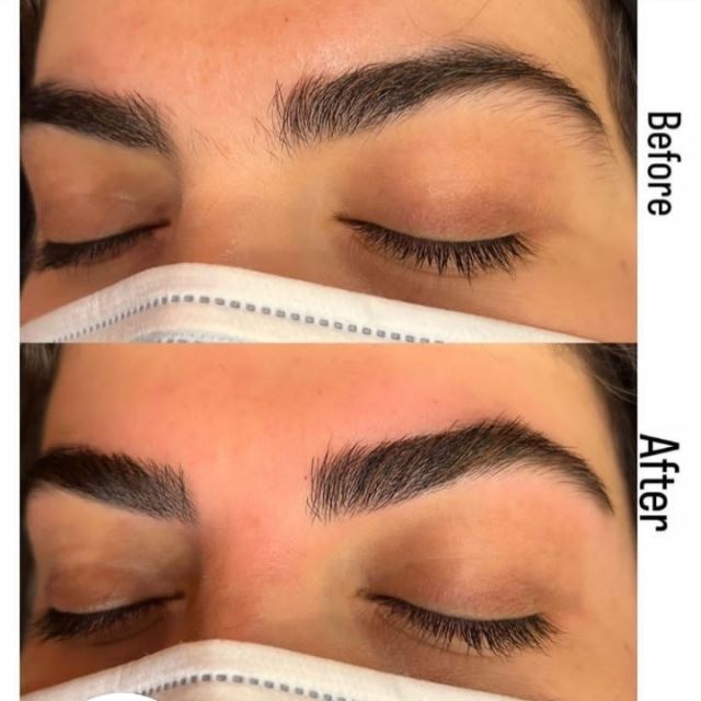 لیفت تخصصی ابرو در تهران