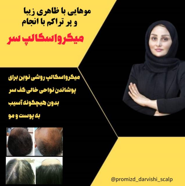 میکرواسکالپ سر