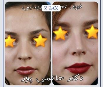 بهترین جراح بینی در شیراز