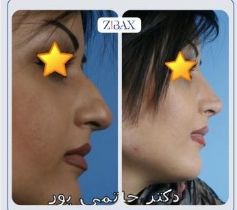 بهترین جراح بینی در شیراز