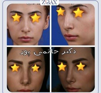 بهترین جراح بینی در شیراز