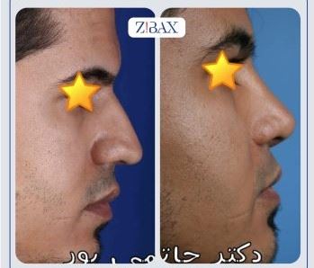 بهترین جراح بینی در شیراز