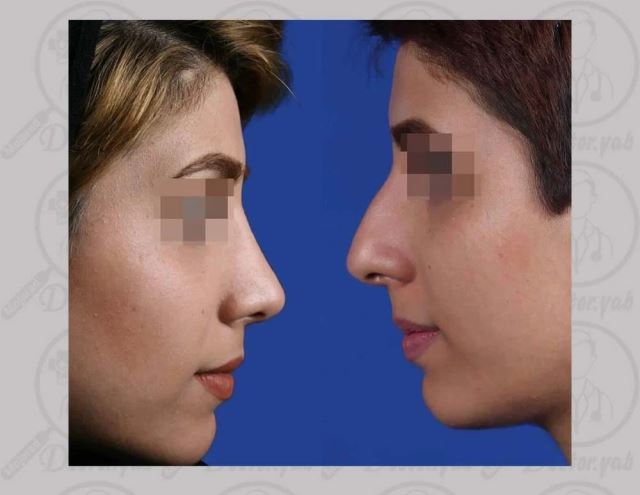 بهترین جراح بینی در شیراز