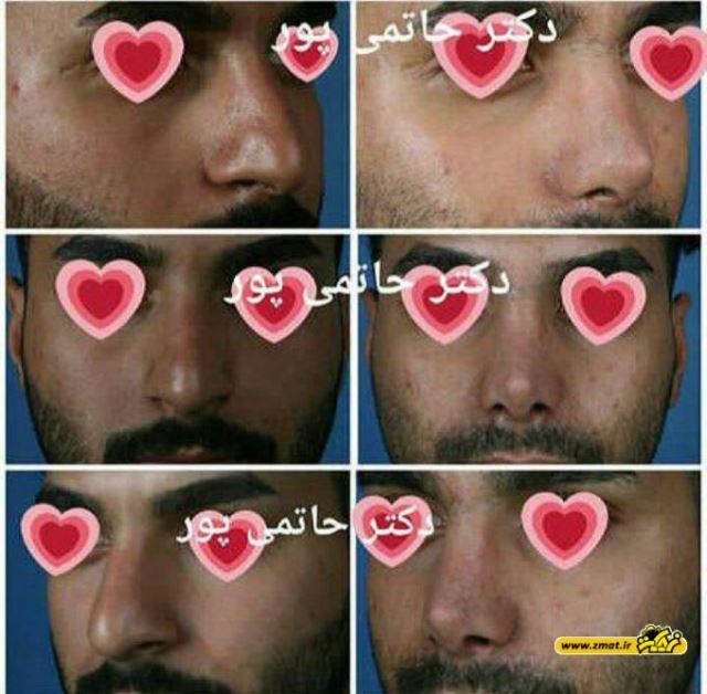 بهترین جراح بینی در شیراز