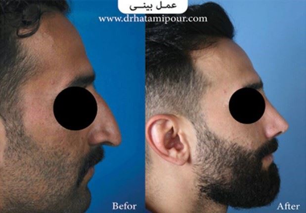 بهترین جراح بینی در شیراز