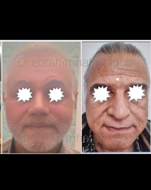 بهترین جراح بینی در شیراز