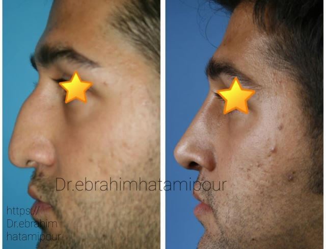 بهترین جراح بینی در شیراز