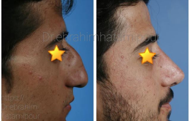 بهترین جراح بینی در شیراز