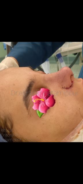 بهترین جراح بینی در شیراز