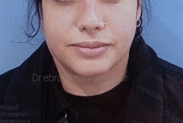 بهترین جراح بینی در شیراز