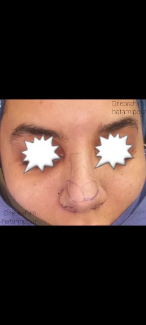 بهترین جراح بینی در شیراز