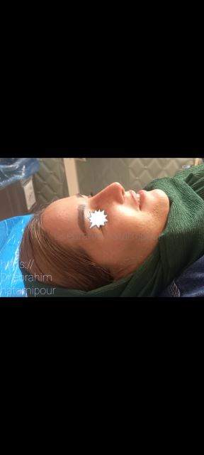 بهترین جراح بینی در شیراز