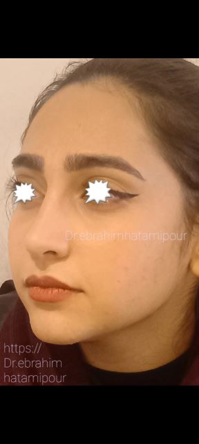 بهترین جراح بینی در شیراز