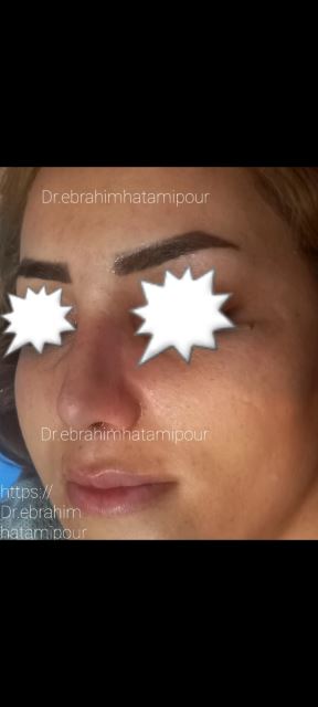 بهترین جراح بینی در شیراز