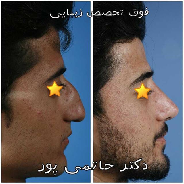 بهترین جراح بینی در شیراز