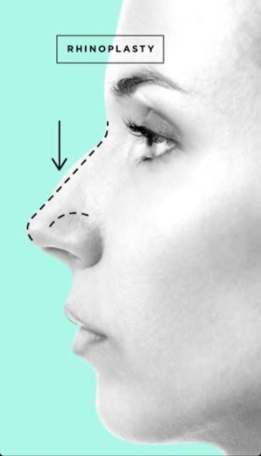 بهترین جراح بینی در شیراز