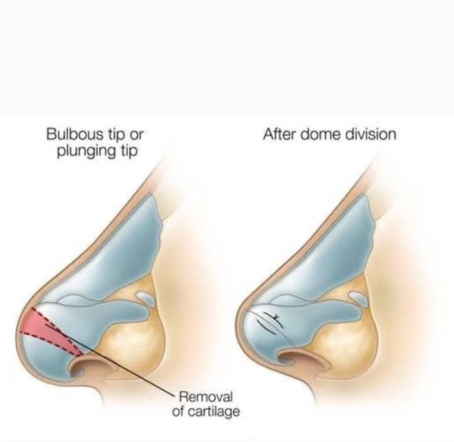 بهترین جراح بینی در شیراز