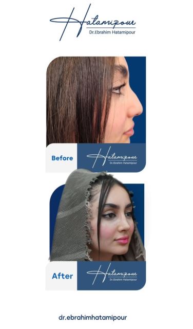 بهترین جراح بینی در شیراز