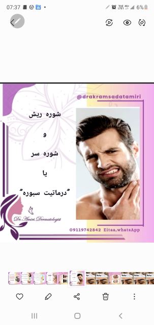 درماتیت سبوره