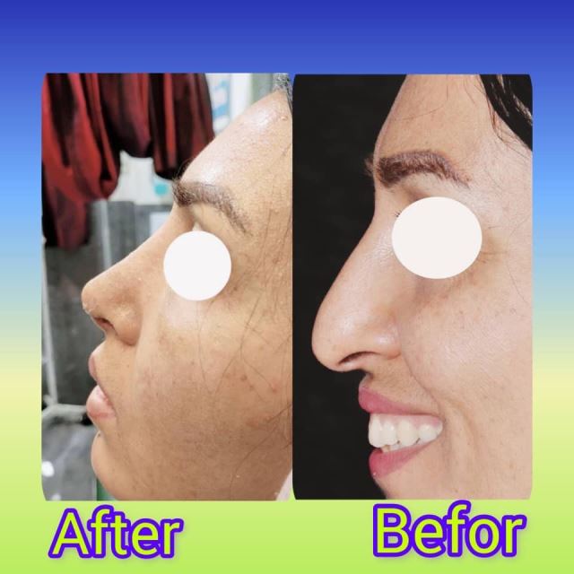 جراح زیبایی