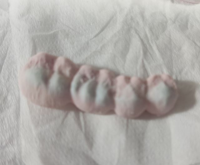 پرسلن گذاری