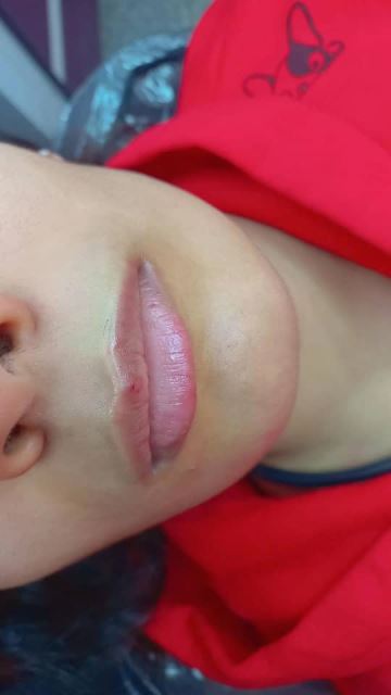 میکرو لب قبل