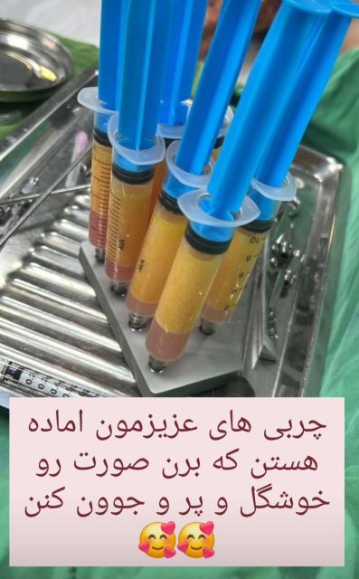 چربی آماده تزریق