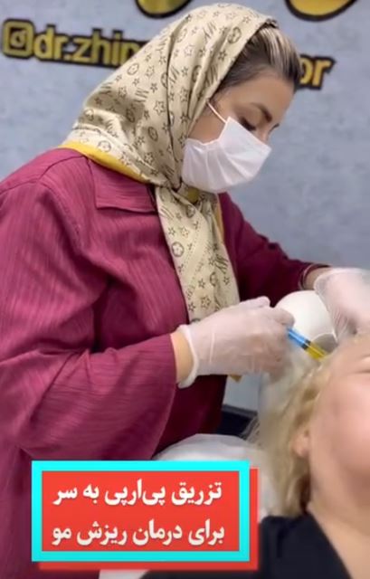 پی آرپی موی سر