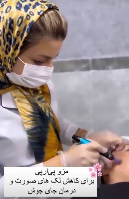 مزو پی آرپی