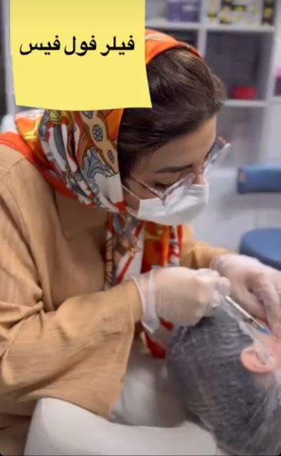 فیلر فول فیس