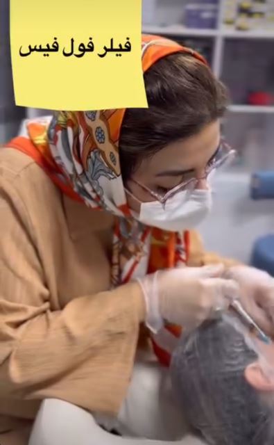 فیلر فول فیس