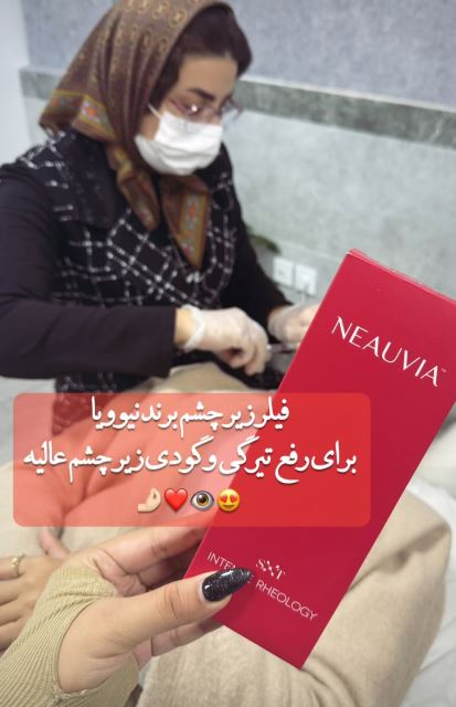 فیلر زیر چشم