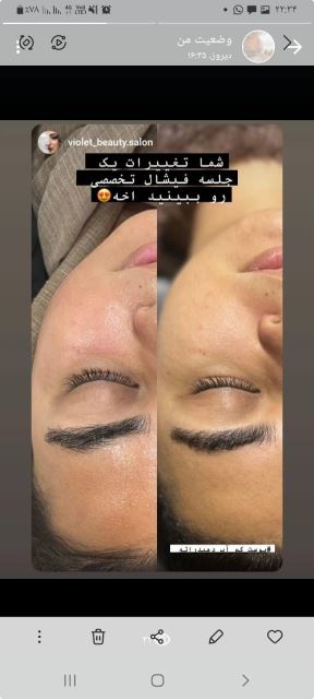 آبرسانی عمقی