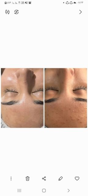 آبرسانی عمقی