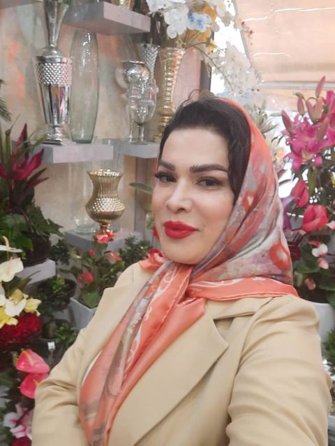 کاشت مو و ابرو در غرب تهران فریبا احمدی