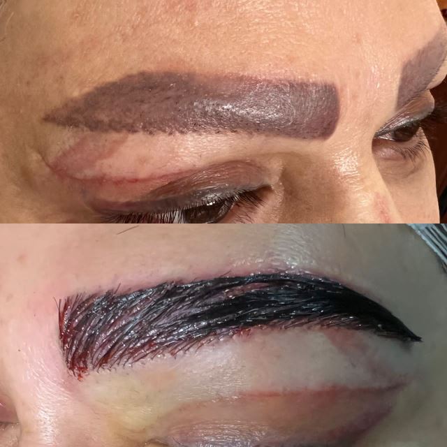 بهترین کاشت ابرو در اردبیل