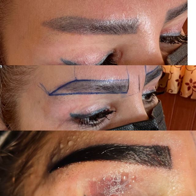 بهترین متخصص کاشت ابرو در اردبیل