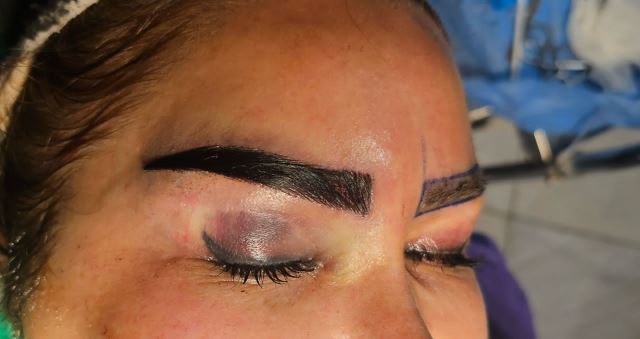 بهترین کلینیک کاشت ابرو در اردبیل