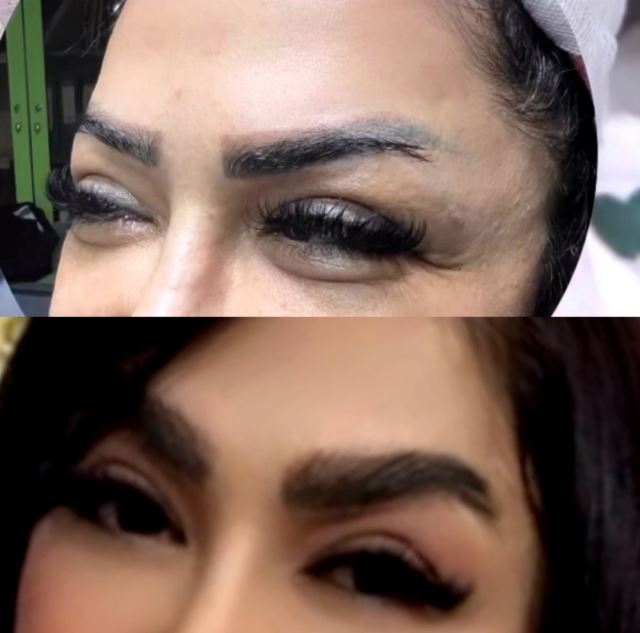 بهترین کلینیک کاشت ابرو در پارس آباد