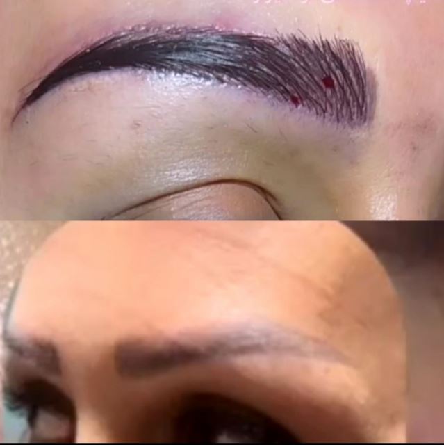 بهترین کلینیک کاشت ابرو در اردبیل