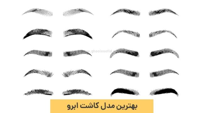 بهترین کلینیک کاشت مو در اردبیل