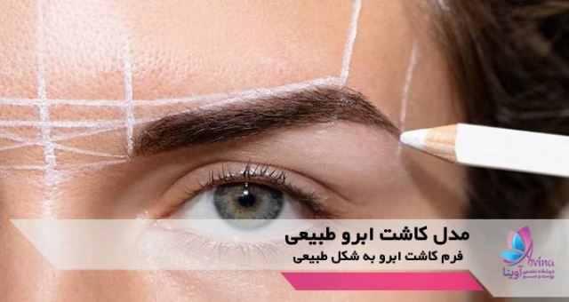 بهترین کلینیک کاشت ابرو در پارس آباد