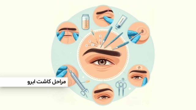 بهترین متخصص کاشت ابرو در پارس آباد