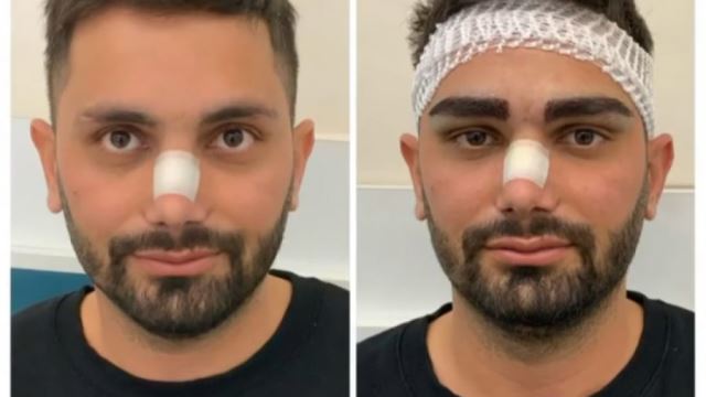 بهترین کلینیک کاشت ابرو در پارس