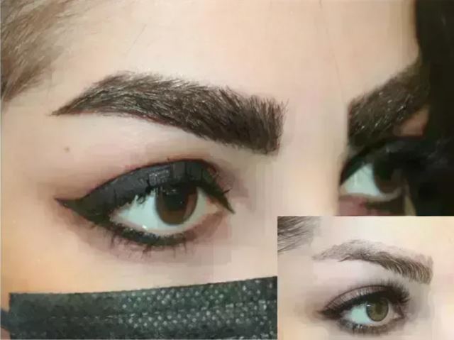 بهترین کلینیک کاشت ابرو در پارس آباد