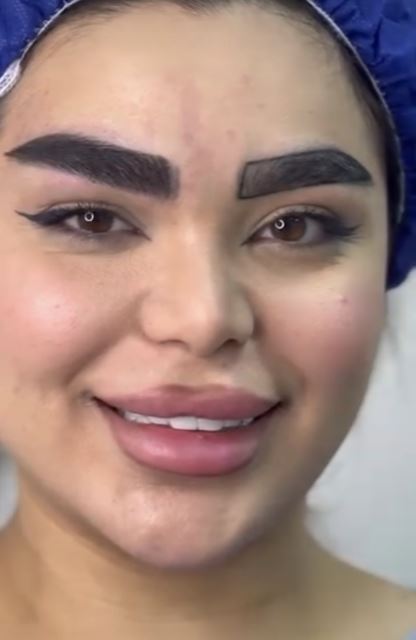 بهترین کلینیک کاشت ابرو در اردبیل