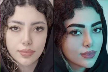 بهترین کلینیک کاشت ابرو در پارس آباد